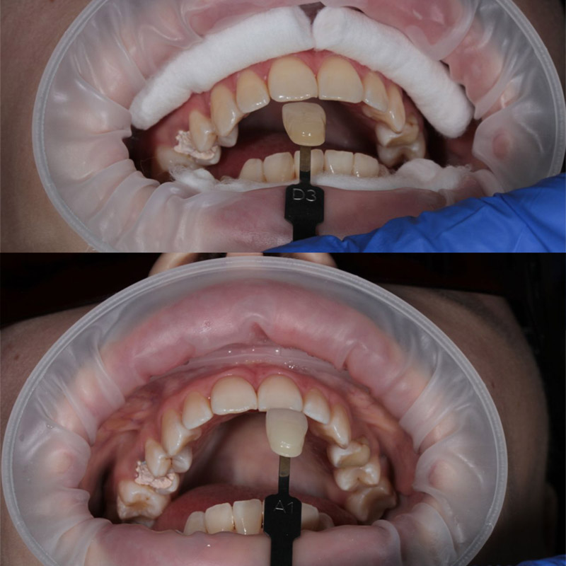 Стоматология томск выдернуть зуб Снимок зуба Томск Верный
